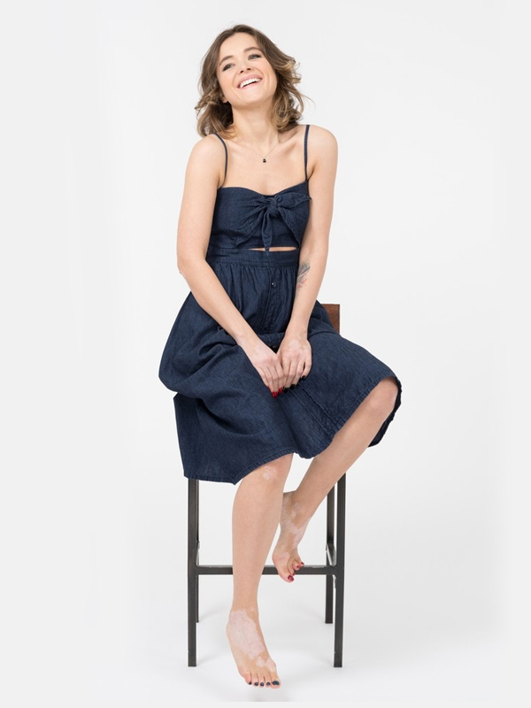 woman with vitiligo smiling and sitting barefoot on a stool wearing a navy blue sleeveless dress against a plain white background